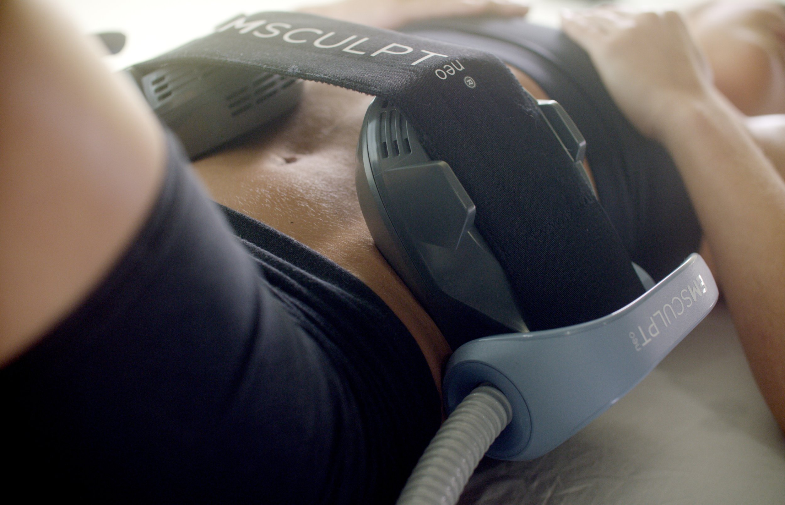 A woman receiving an Emsculpt NEO treatment on her abdomen, with applicators placed on her skin to reduce fat and tone muscle.